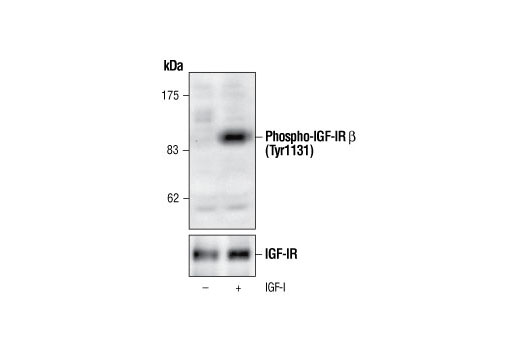 Western Blotting Image 2: Phospho-IGF-I Receptor β (Tyr1131)/Insulin Receptor β (Tyr1146) Antibody