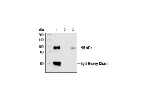 Immunoprecipitation Image 1: Insulin Receptor β (4B8) Rabbit mAb