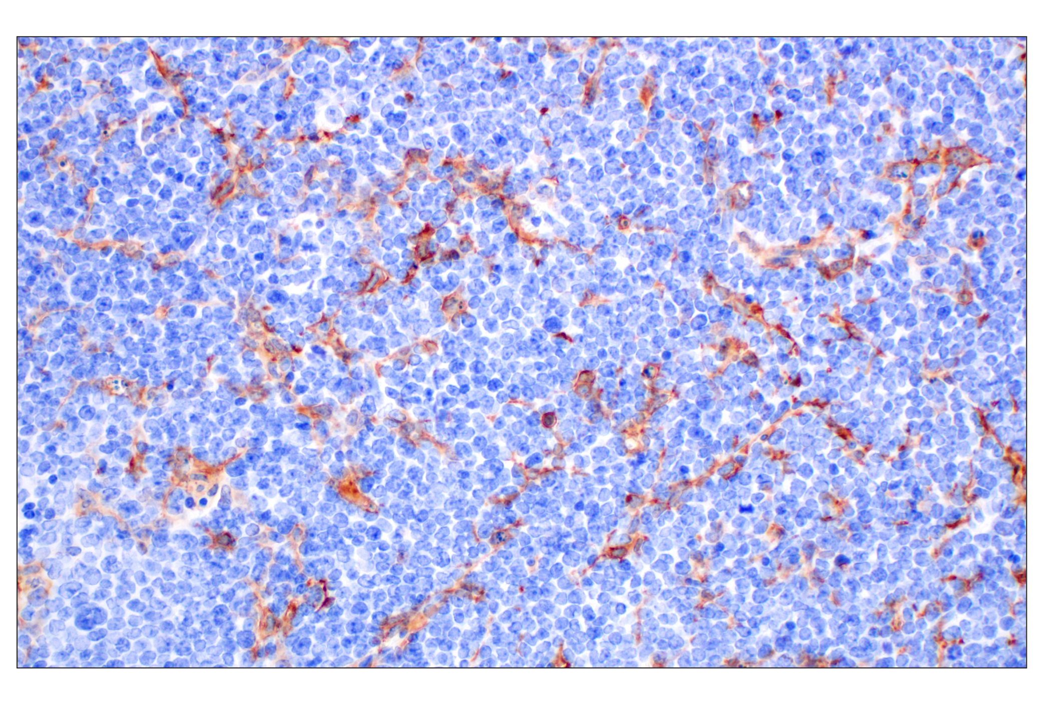 Immunohistochemistry Image 1: Dectin-1/ Clec7a (E3P5W) Rabbit mAb