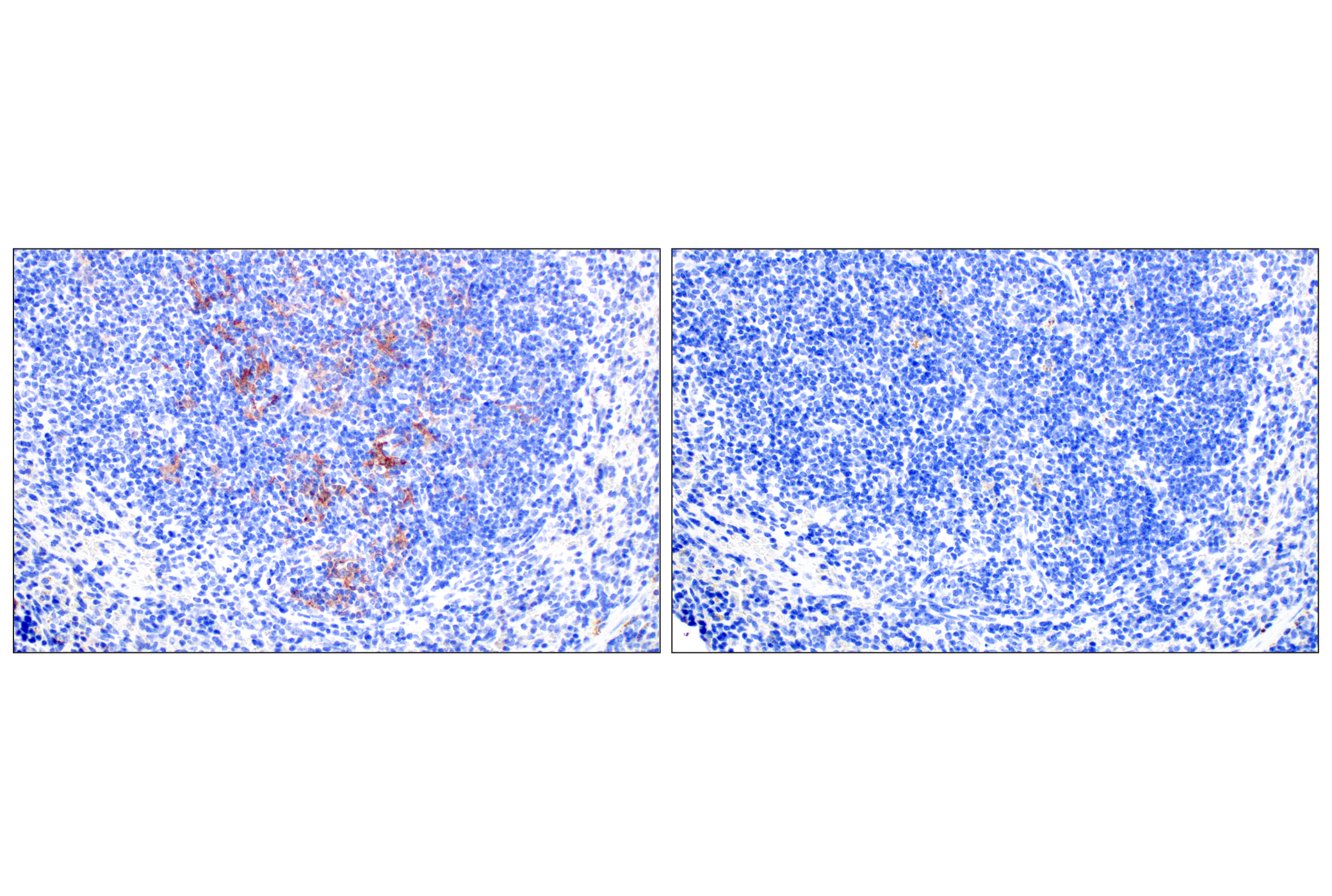 Immunohistochemistry Image 6: Dectin-1/ Clec7a (E3P5W) Rabbit mAb