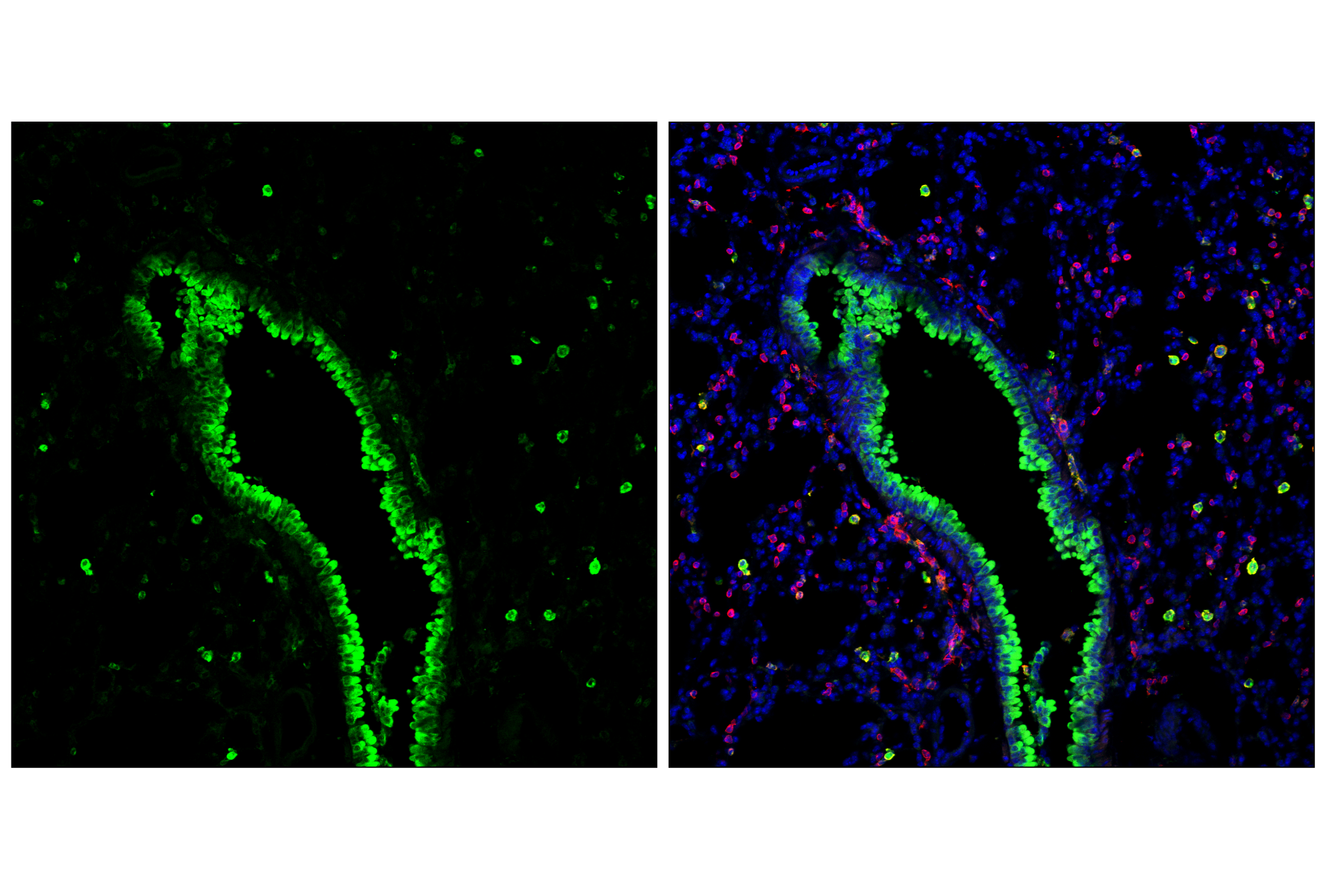 Immunofluorescence Image 2: Dectin-1/ Clec7a (E3P5W) Rabbit mAb