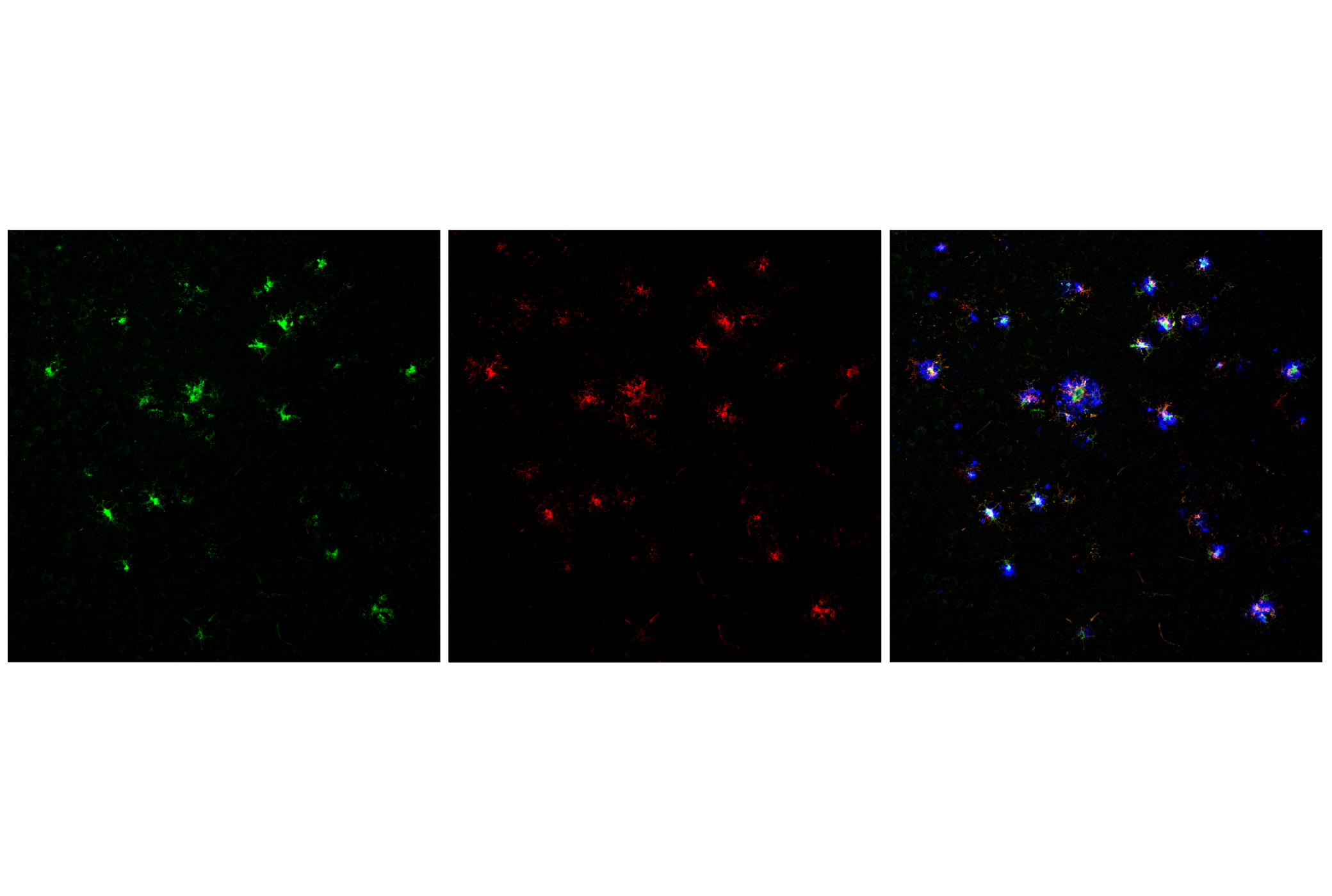 Immunofluorescence Image 1: Dectin-1/ Clec7a (E3P5W) Rabbit mAb