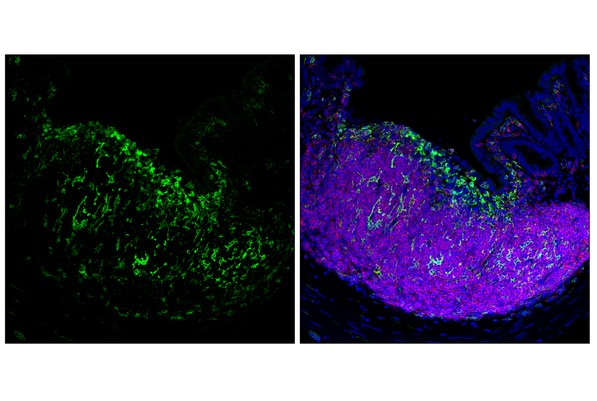 Immunofluorescence Image 3: Dectin-1/ Clec7a (E3P5W) Rabbit mAb