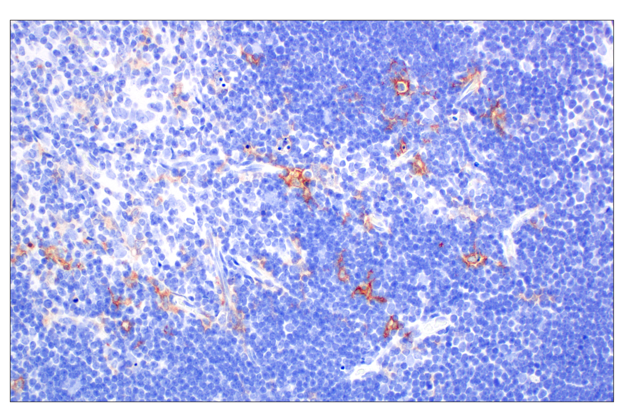 Immunohistochemistry Image 4: Dectin-1/ Clec7a (E3P5W) Rabbit mAb