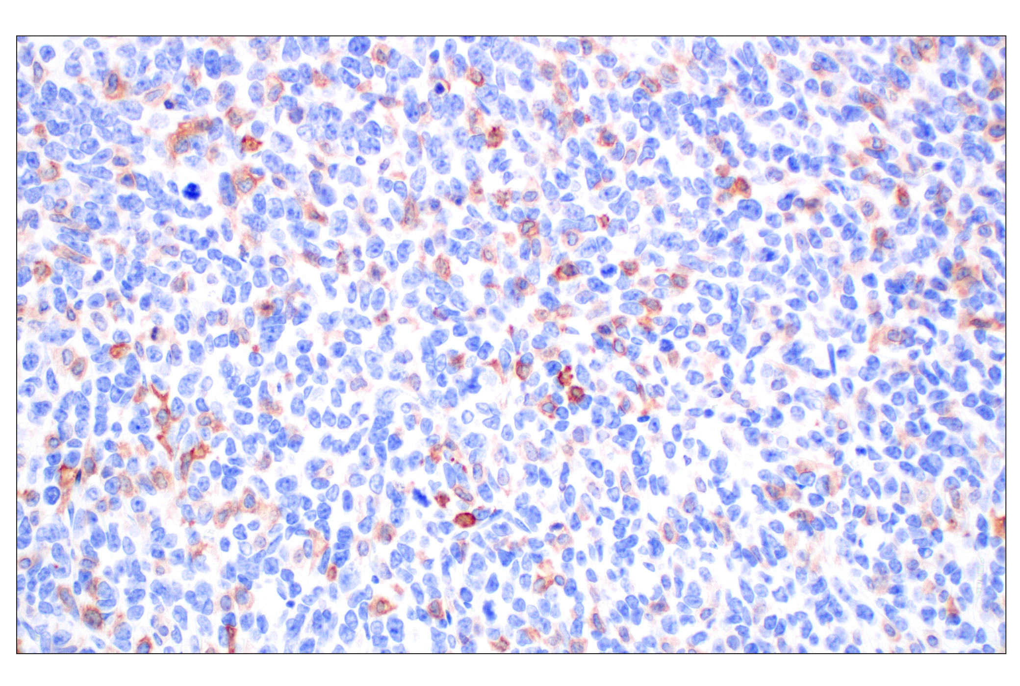Immunohistochemistry Image 2: Dectin-1/ Clec7a (E3P5W) Rabbit mAb