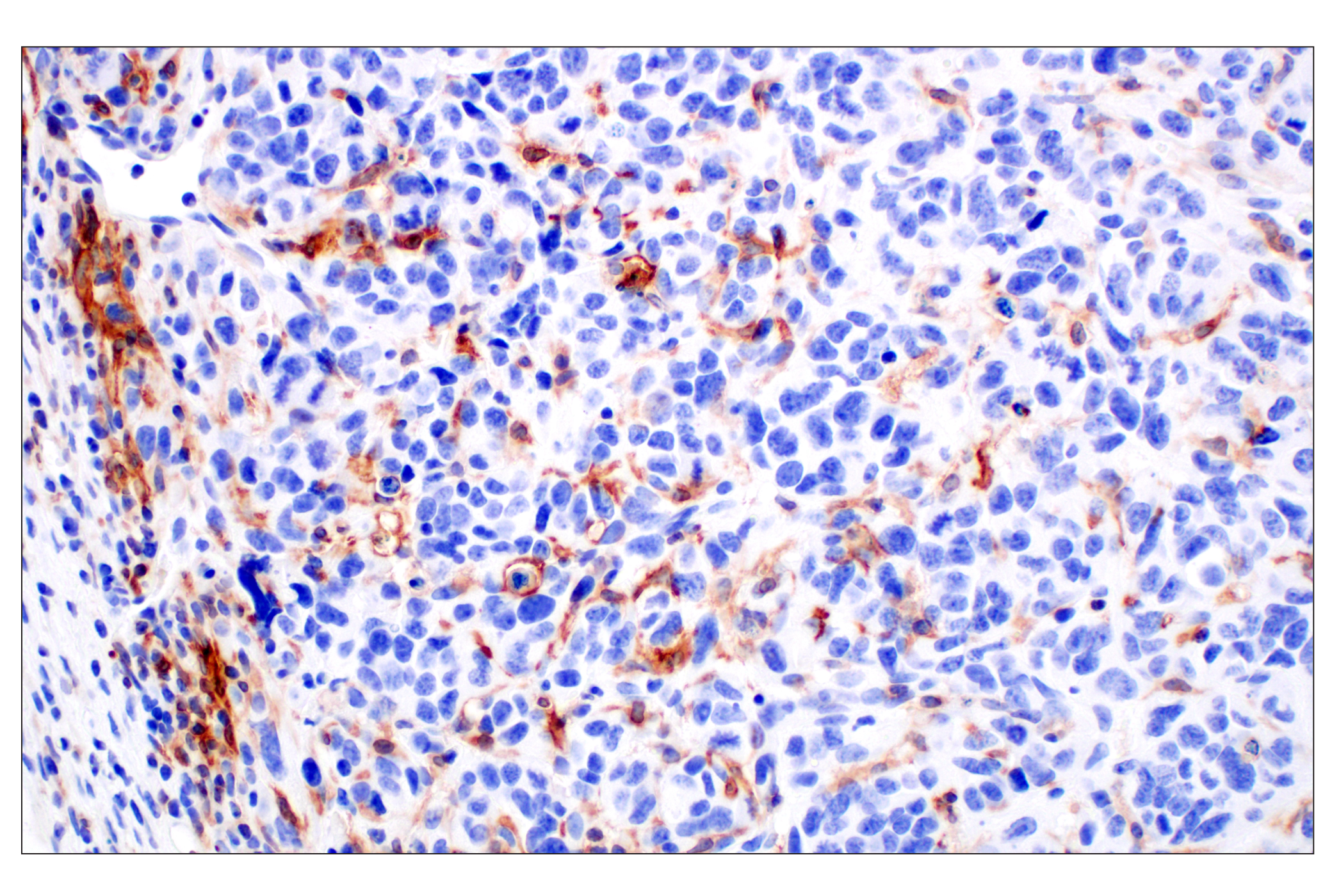 Immunohistochemistry Image 3: Dectin-1/ Clec7a (E3P5W) Rabbit mAb