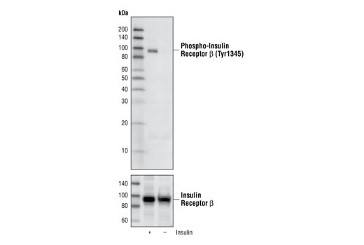 Western Blotting Image 1: Phospho-Insulin Receptor β (Tyr1345) (14A4) Rabbit mAb