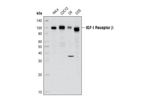 Western Blotting Image 1: IGF-I Receptor β Antibody