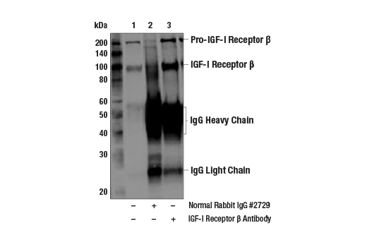 Immunoprecipitation Image 1: IGF-I Receptor β Antibody