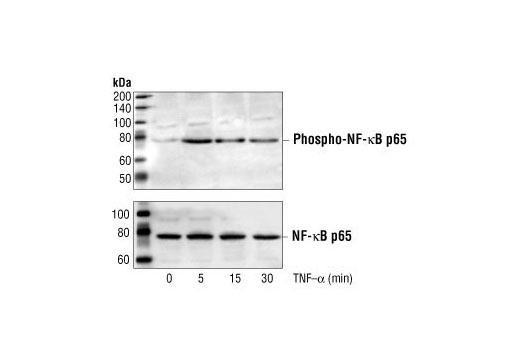 Western Blotting Image 1: Phospho-NF-κB p65 (Ser536) Antibody