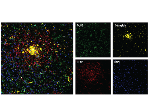 Immunofluorescence Image 1: F4/80 (D4C8V) XP® Rabbit mAb