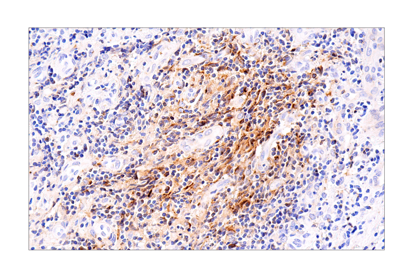 Immunohistochemistry Image 1: CXCL9/MIG (E6Z5W) Rabbit mAb