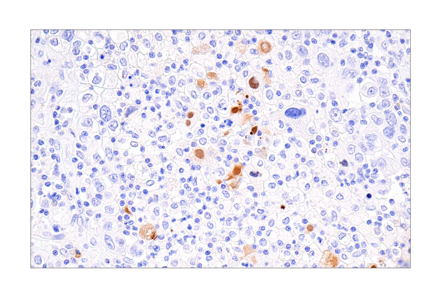 Immunohistochemistry Image 3: CXCL9/MIG (E6Z5W) Rabbit mAb
