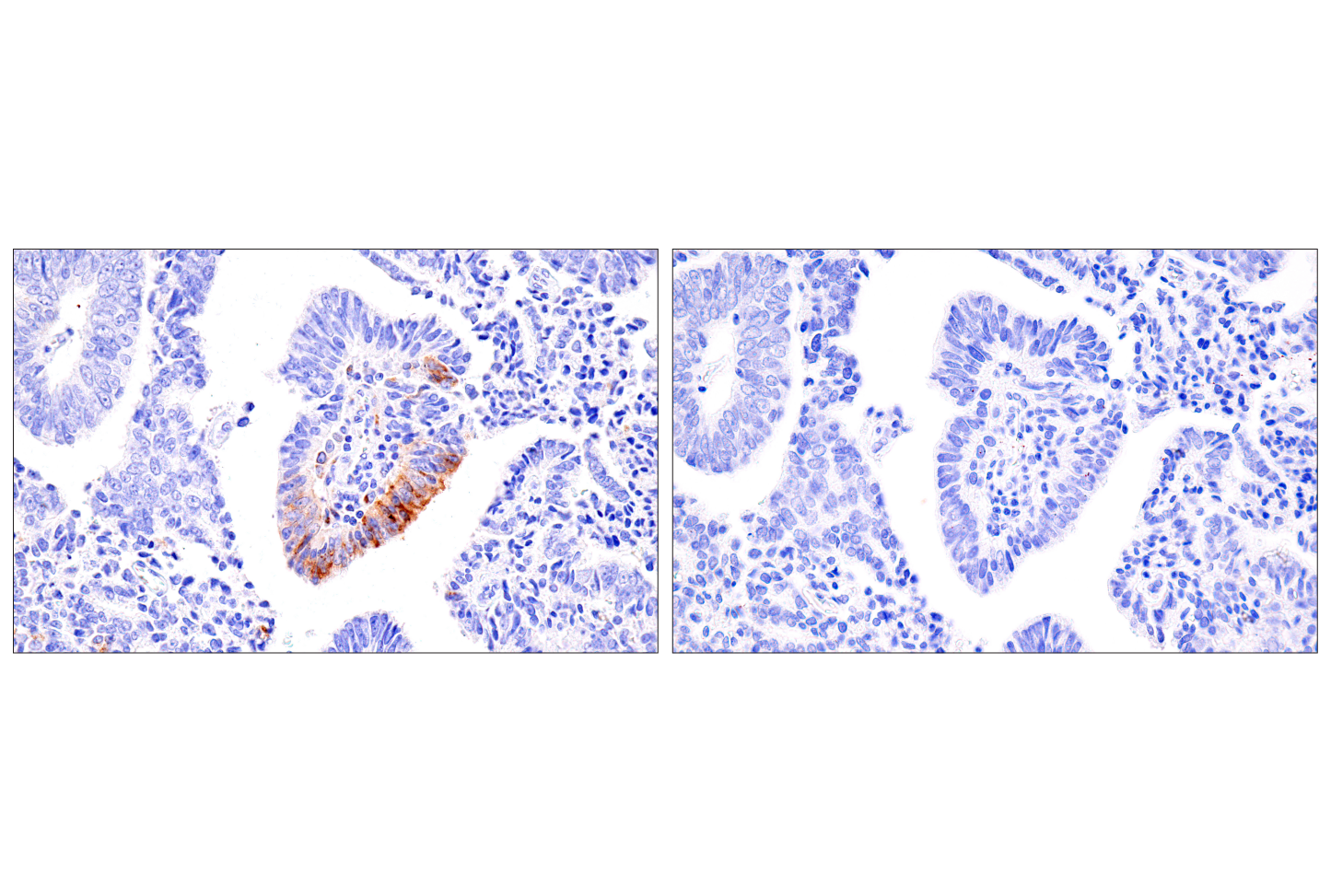 Immunohistochemistry Image 5: CXCL9/MIG (E6Z5W) Rabbit mAb
