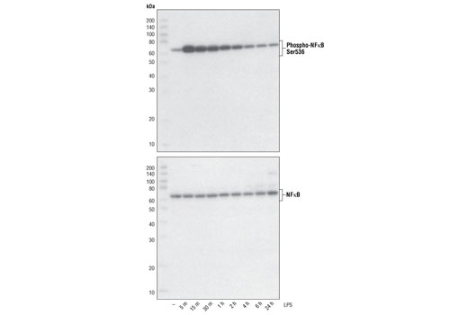  Image 12: NF-κB Pathway Antibody Sampler Kit