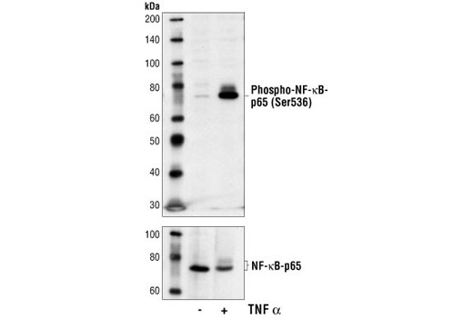 Western Blotting Image 1: Phospho-NF-κB p65 (Ser536) (7F1) Mouse mAb