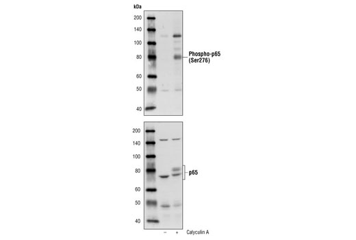 Western Blotting Image 1: Phospho-NF-κB p65 (Ser276) Antibody