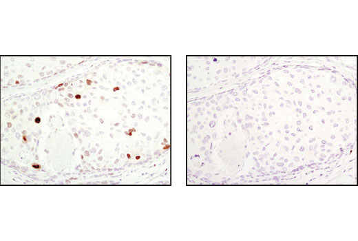 Immunohistochemistry Image 1: Phospho-NF-κB p65 (Ser276) Antibody