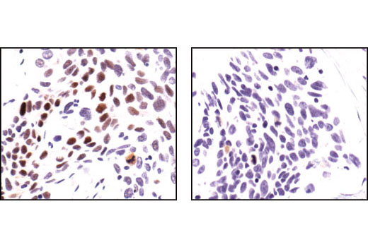 Immunohistochemistry Image 2: Phospho-NF-κB p65 (Ser276) Antibody
