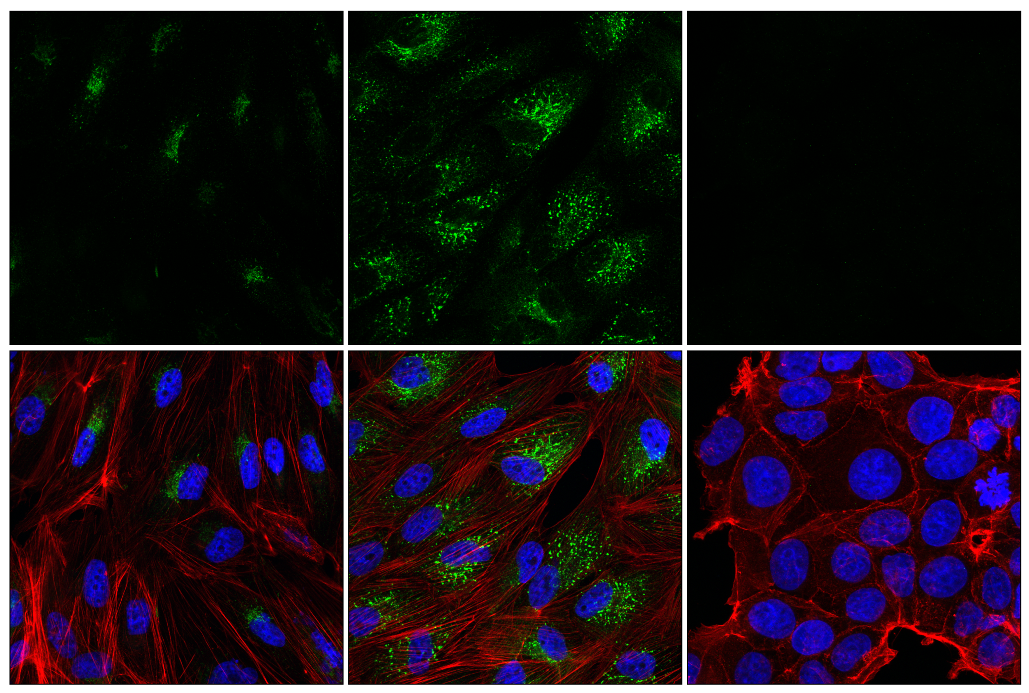 Immunofluorescence Image 1: IL-6 (E1D1N) Rabbit mAb