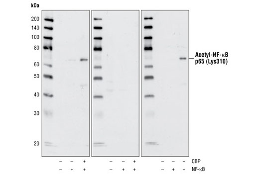 Western Blotting Image 1: Acetyl-NF-κB p65 (Lys310) Antibody