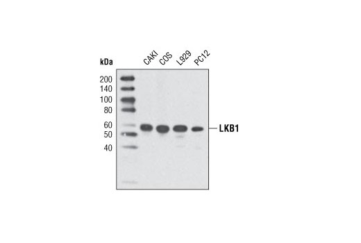  Image 1: PhosphoPlus® LKB1 (Ser428) Antibody Duet
