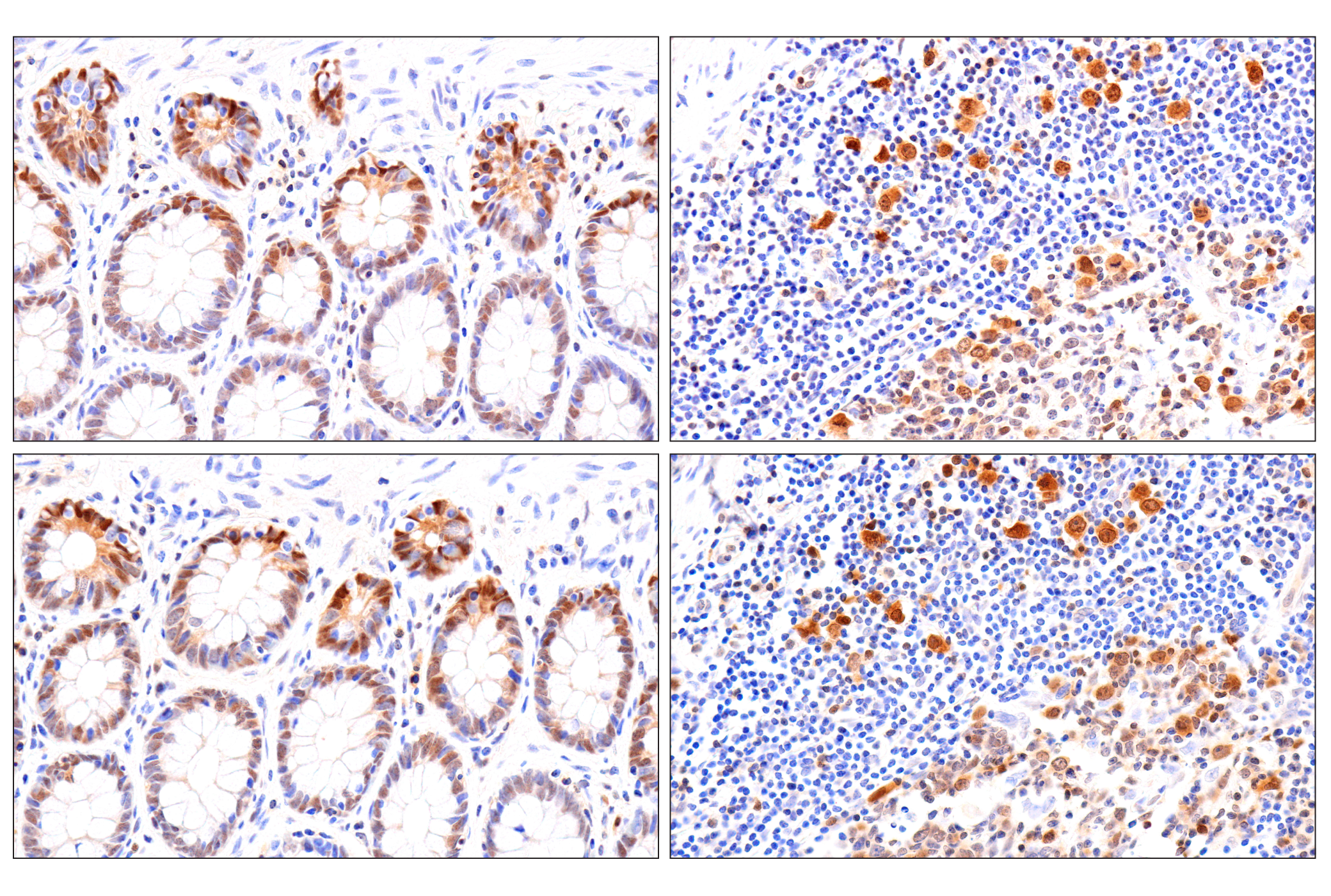 Immunohistochemistry Image 16: CDK6 (E3E3Q) Rabbit mAb