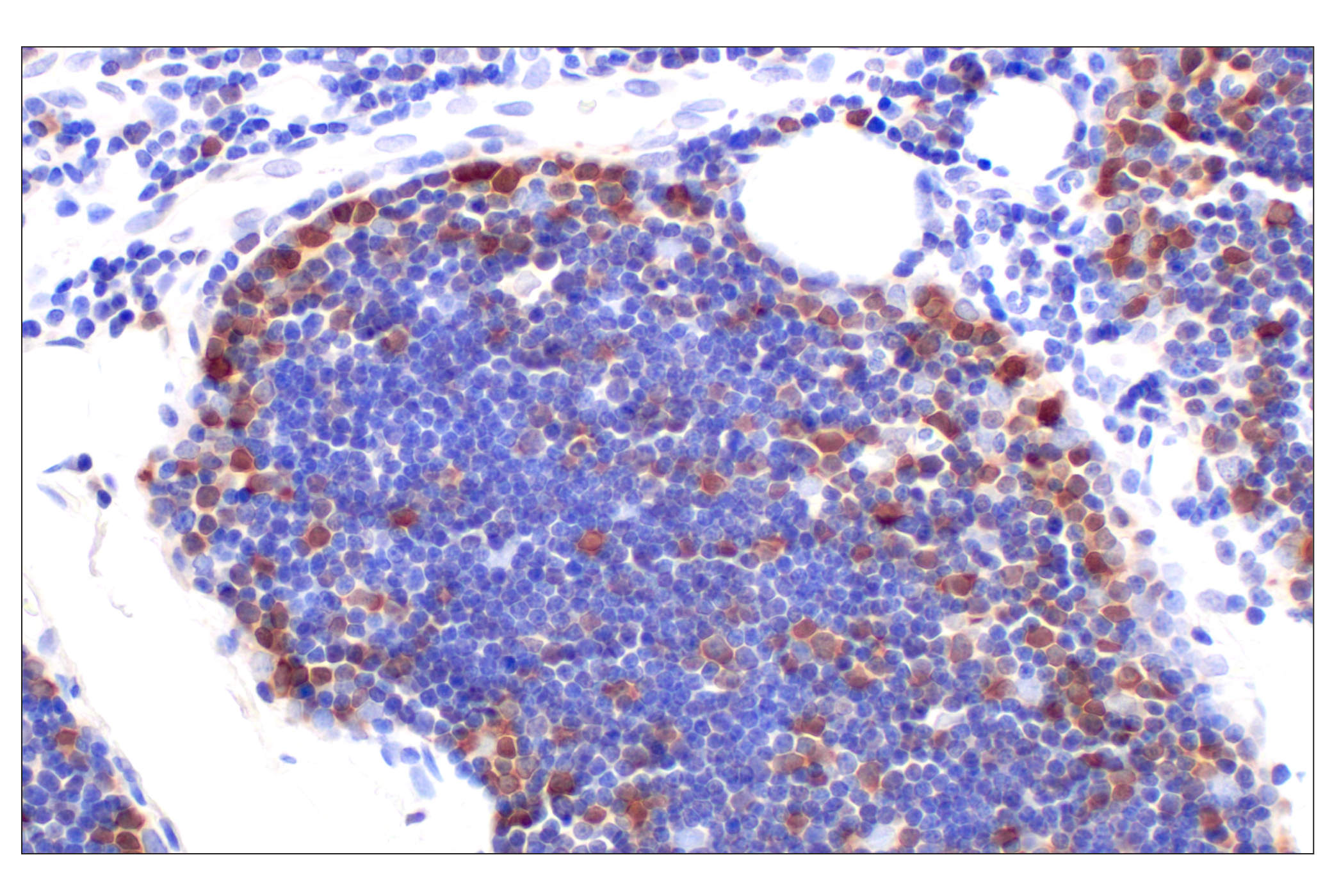 Immunohistochemistry Image 4: CDK6 (E3E3Q) Rabbit mAb