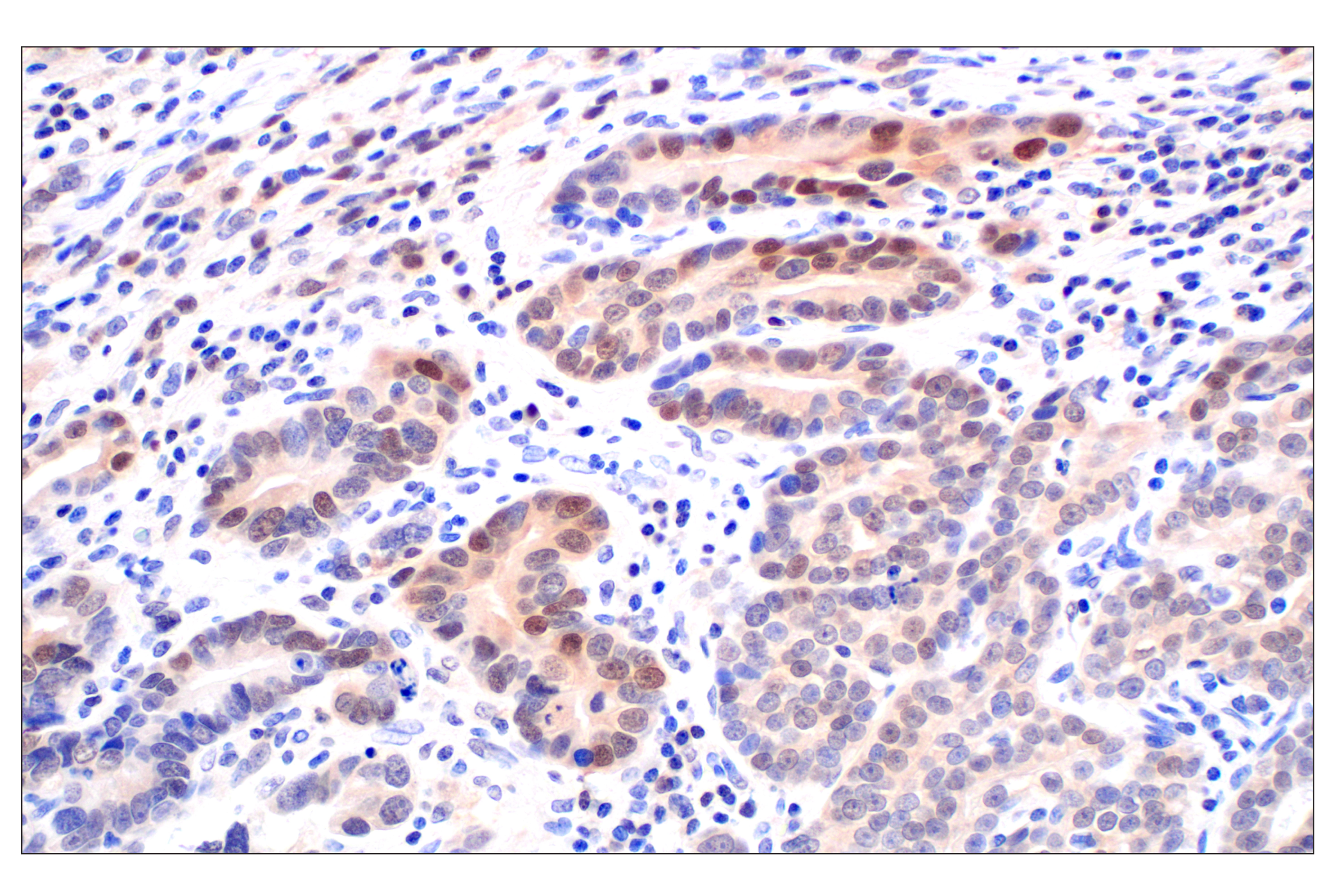 Immunohistochemistry Image 2: CDK6 (E3E3Q) Rabbit mAb