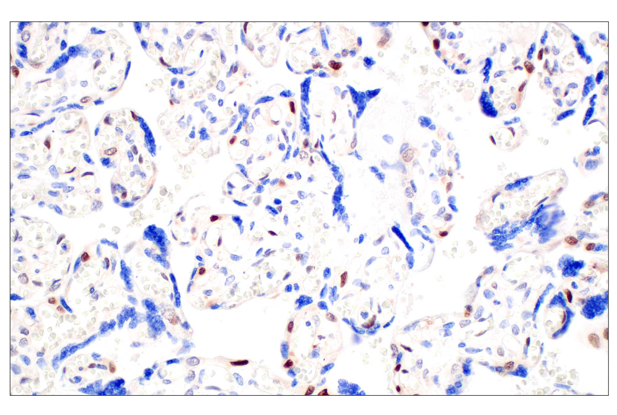 Immunohistochemistry Image 5: CDK6 (E3E3Q) Rabbit mAb