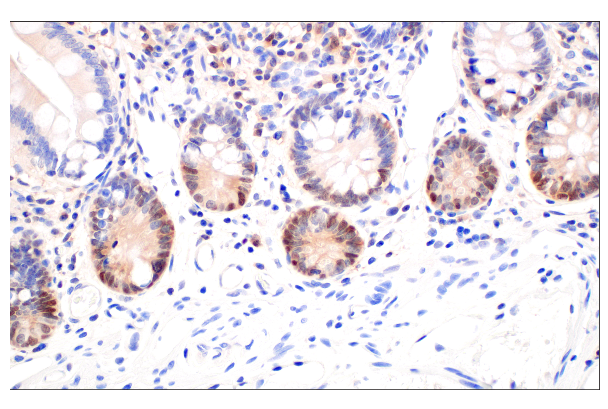 Immunohistochemistry Image 6: CDK6 (E3E3Q) Rabbit mAb