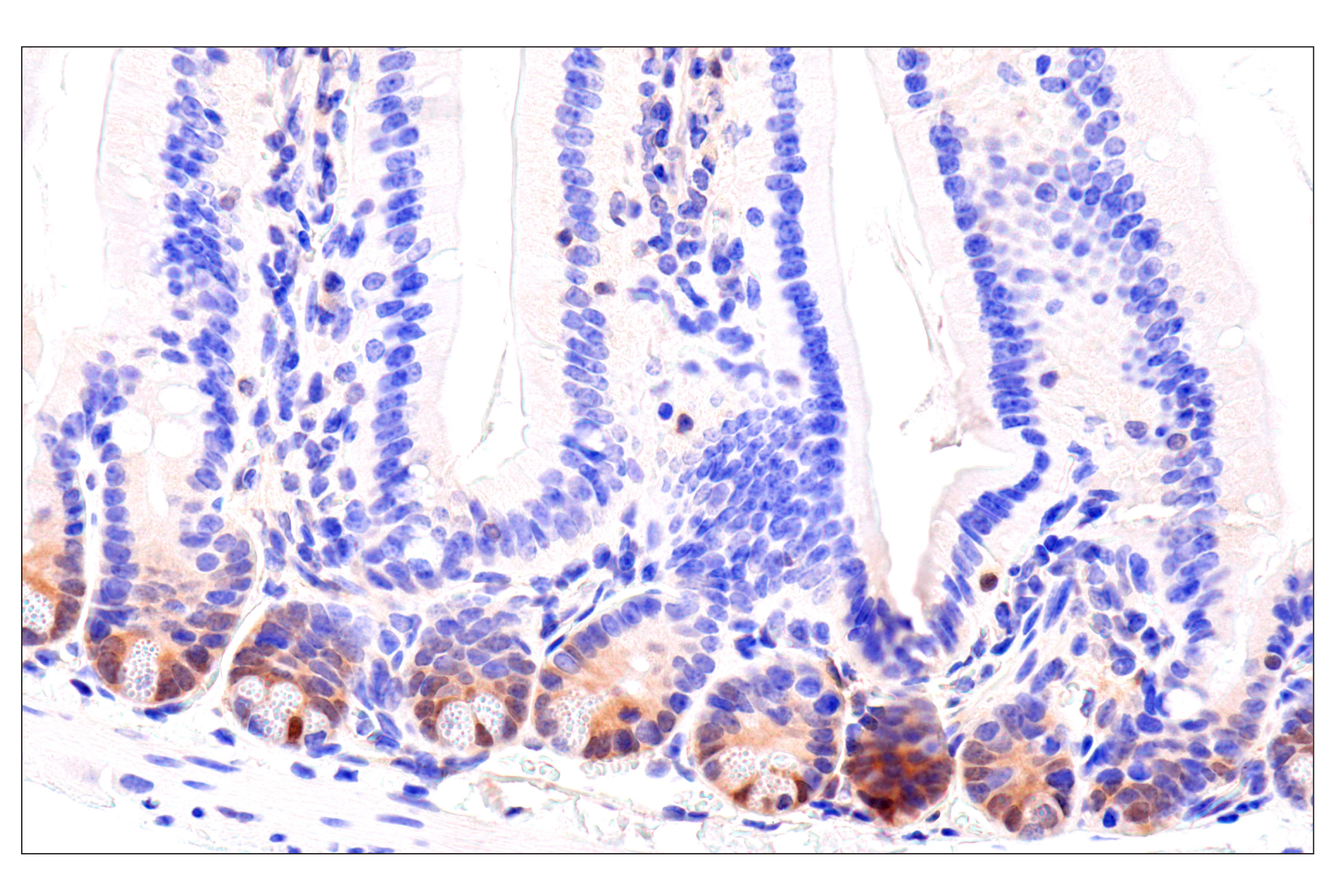 Immunohistochemistry Image 12: CDK6 (E3E3Q) Rabbit mAb
