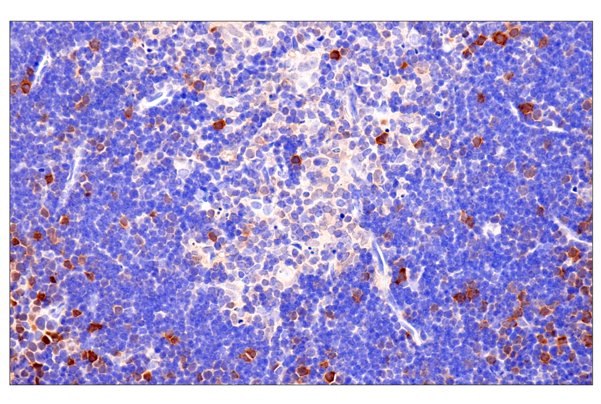 Immunohistochemistry Image 15: CDK6 (E3E3Q) Rabbit mAb