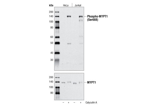 Western Blotting Image 1: Phospho-MYPT1 (Ser668) Antibody