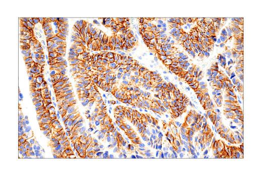 Immunohistochemistry Image 1: Syndecan 1 (IHC138) Mouse mAb