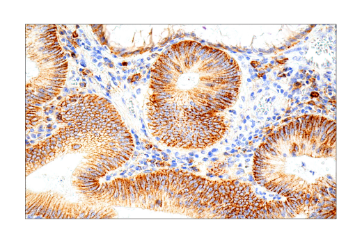 Immunohistochemistry Image 2: Syndecan 1 (IHC138) Mouse mAb