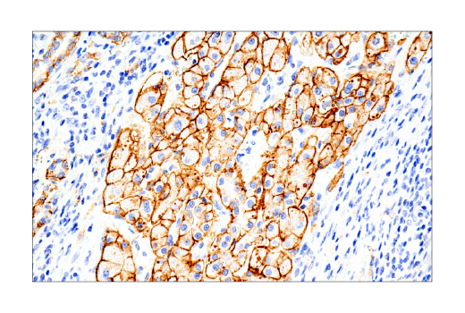 Immunohistochemistry Image 3: Syndecan 1 (IHC138) Mouse mAb