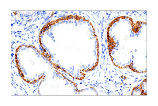 Immunohistochemistry Image 4: Syndecan 1 (IHC138) Mouse mAb