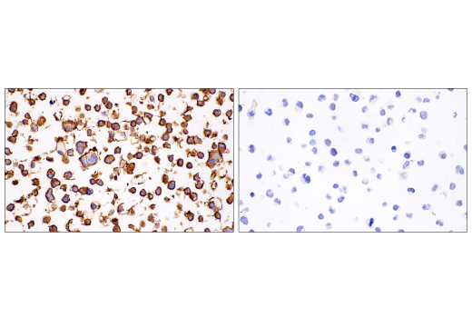 Immunohistochemistry Image 5: Syndecan 1 (IHC138) Mouse mAb