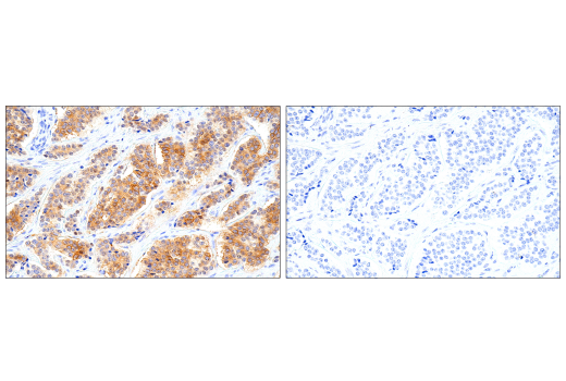 Immunohistochemistry Image 6: Syndecan 1 (IHC138) Mouse mAb