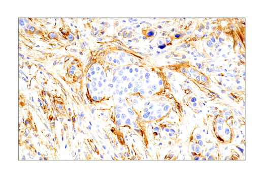 Immunohistochemistry Image 8: Syndecan 1 (IHC138) Mouse mAb