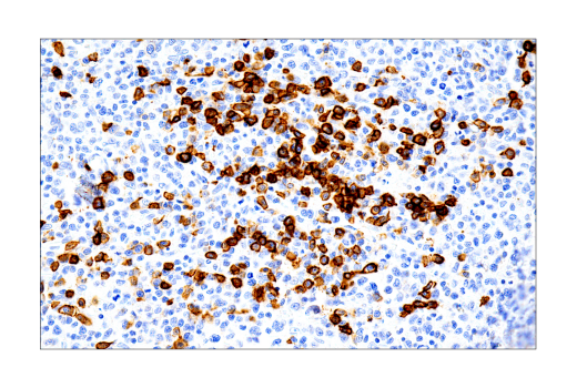 Immunohistochemistry Image 9: Syndecan 1 (IHC138) Mouse mAb