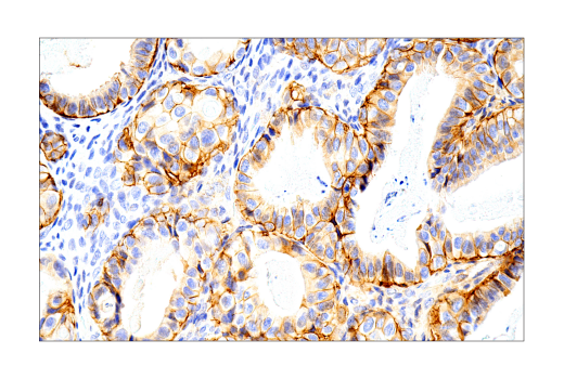 Immunohistochemistry Image 10: Syndecan 1 (IHC138) Mouse mAb