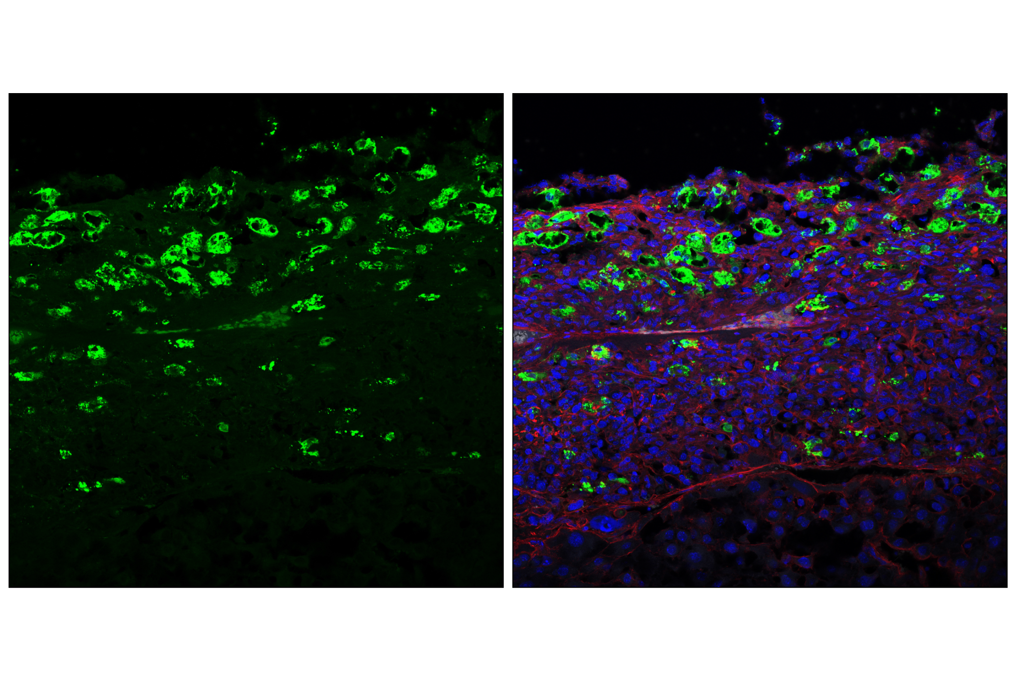 Immunofluorescence Image 1: Granzyme F (E2U7L) Rabbit mAb (BSA and Azide Free)