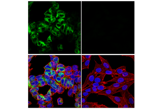 Immunofluorescence Image 4: Neurofilament-H (E7Z7G) Rabbit mAb