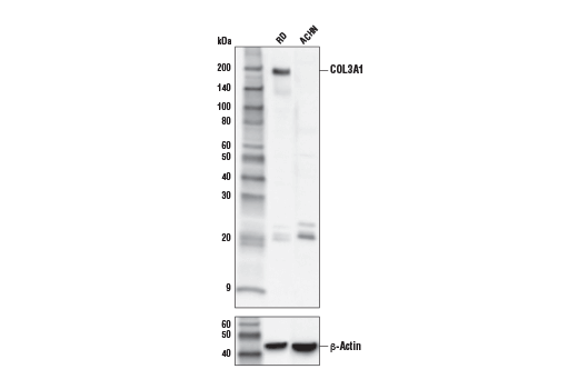 Western Blotting Image 1: COL3A1 Antibody