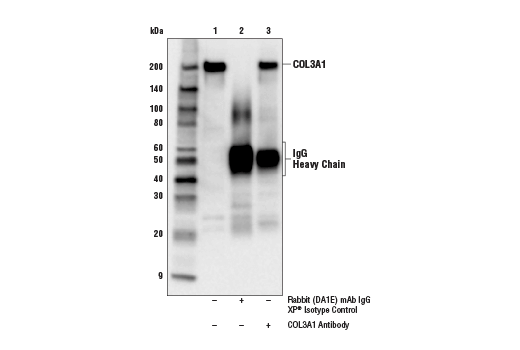Immunoprecipitation Image 1: COL3A1 Antibody
