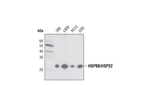 Western Blotting Image 1: HSPB8/HSP22 Antibody