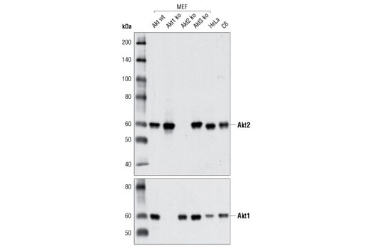  Image 2: Akt Isoform Antibody Sampler Kit