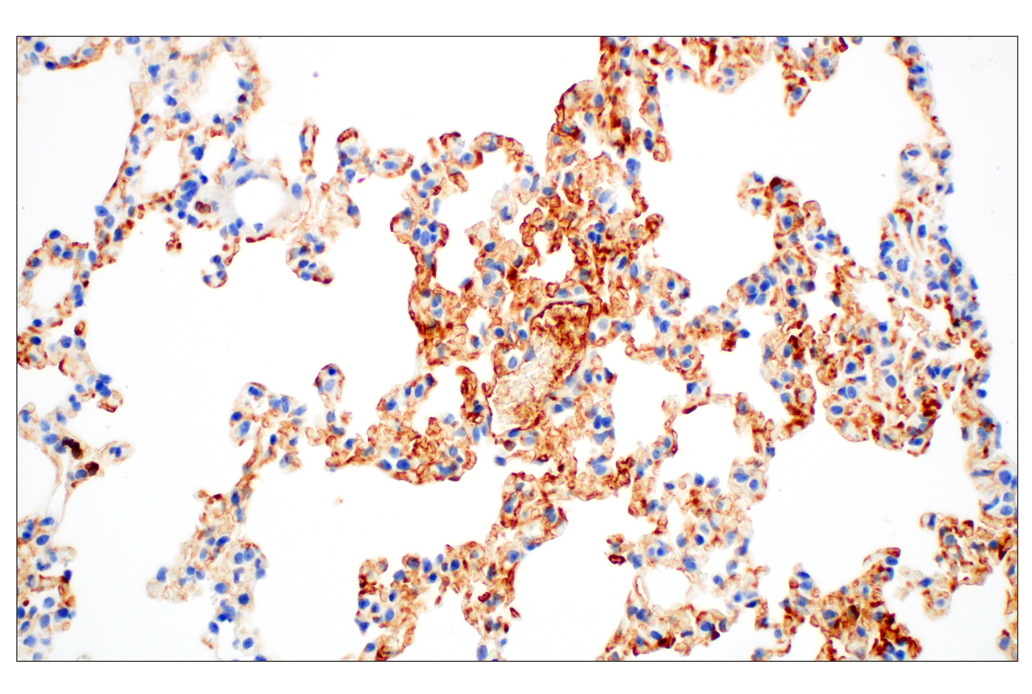 Immunohistochemistry Image 3: C1QB (E3U6X) Rabbit mAb